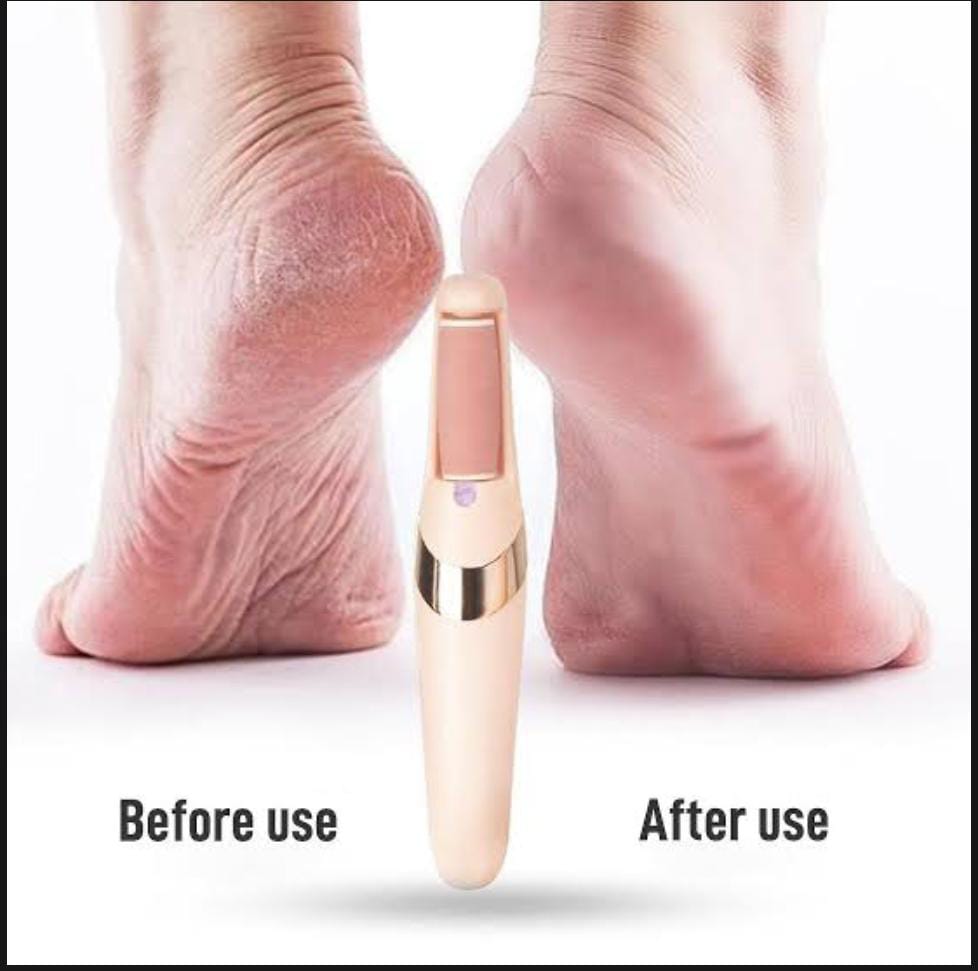 Rechargeable Electric Foot File Callus Remover Pedicure Machine Apparatus for Heels Grinding Device Foot Corns Remove Roller Feet Care  Original China BIG SIZE